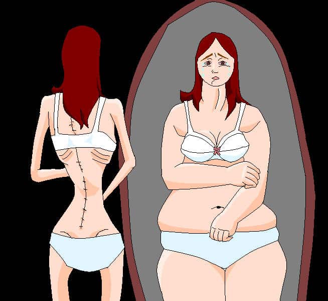 anorexique miroir dysmorphophobie